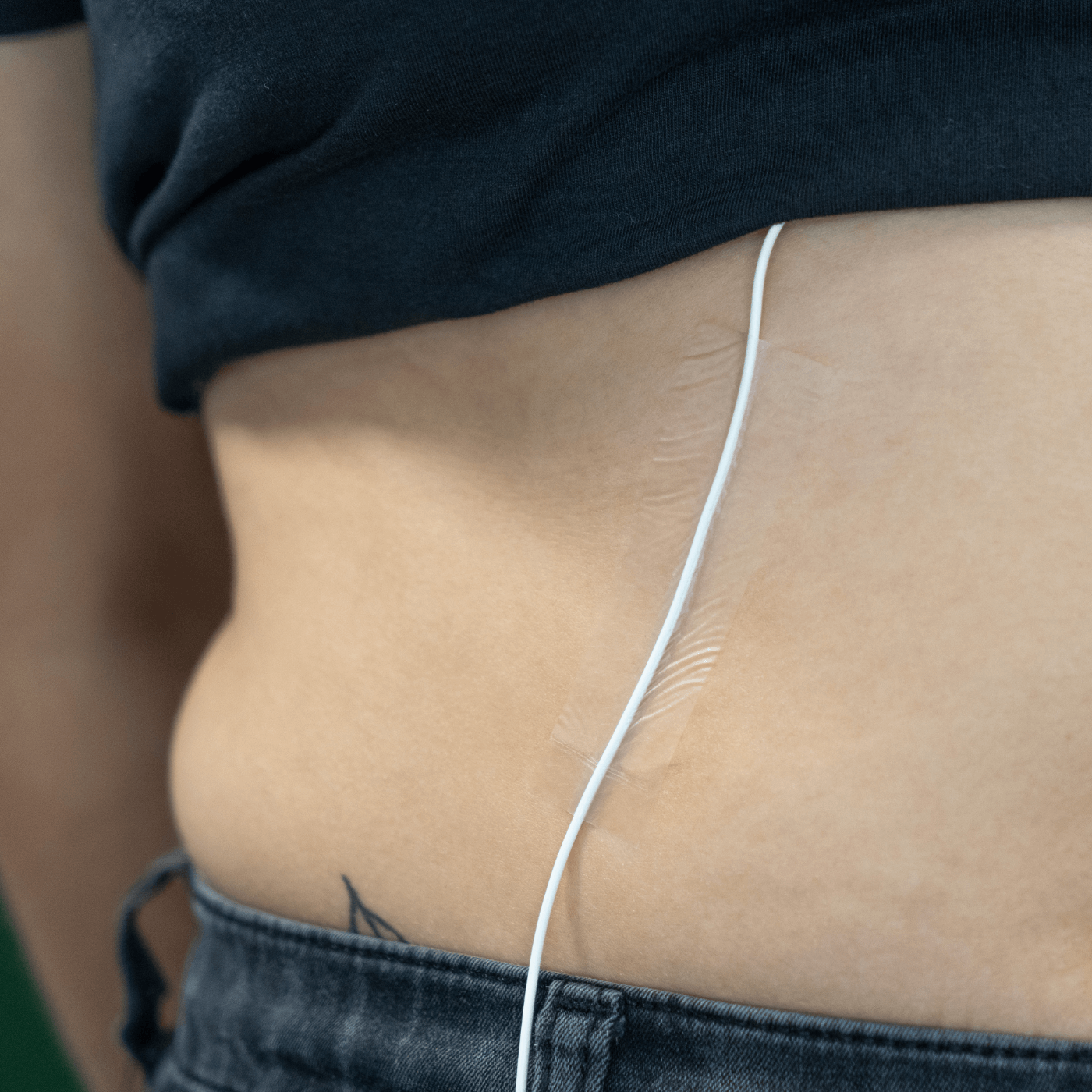 The Invisible Skin Tape